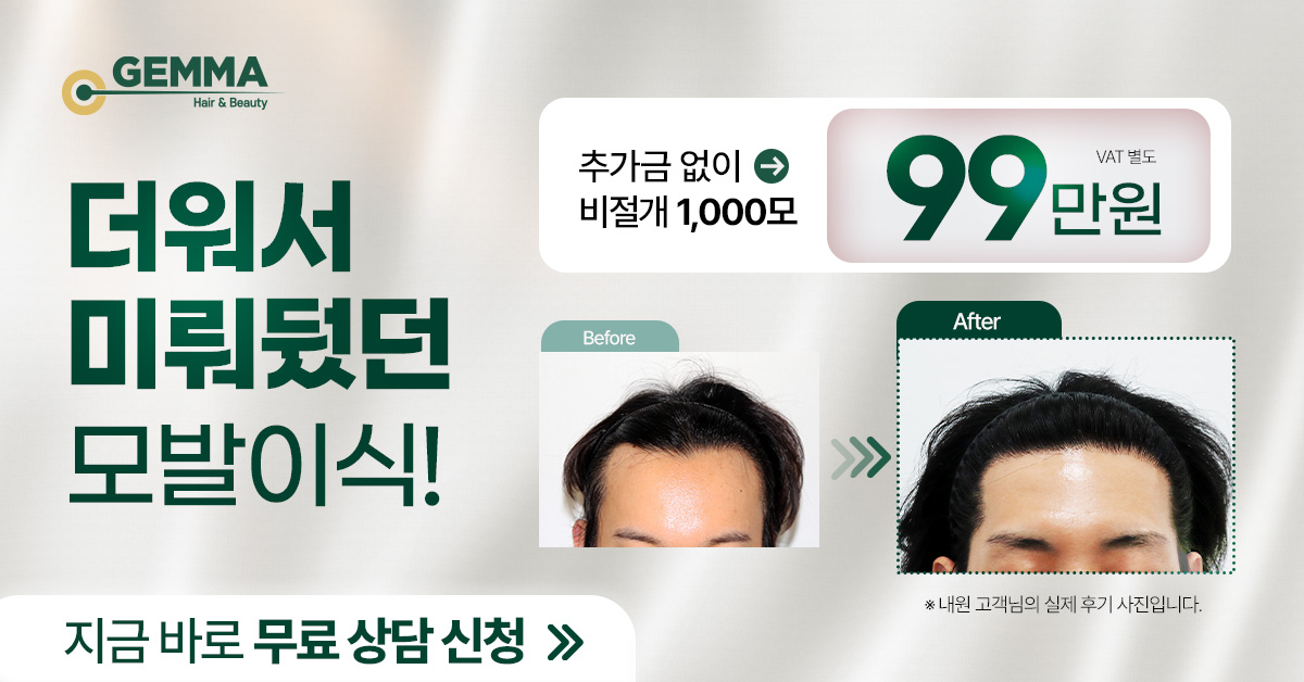 20년전 가격 그대로! 비절개 모발이식 99만원! 2